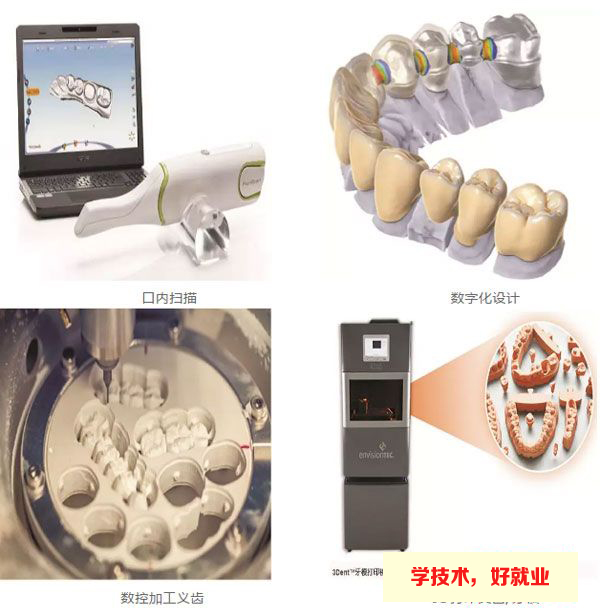 數字化口腔技術專業做什么的